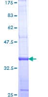Human RAMP1 Protein (Recombinant GST, N-terminus)