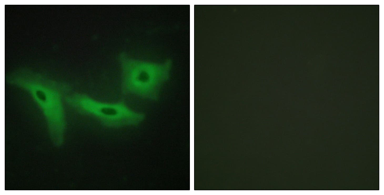 LRRK1 Antibody (aa361-410)