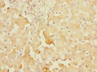 SOAT2 Antibody
