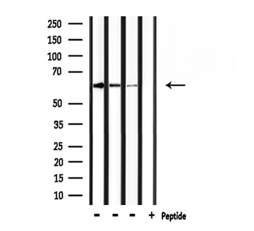 Polyclonal Rabbit anti-Human RANGAP1 Antibody (IHC, WB)