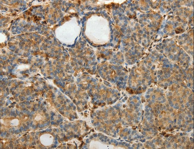 SULT1E1 / Sulfotransferase 1E1 Antibody