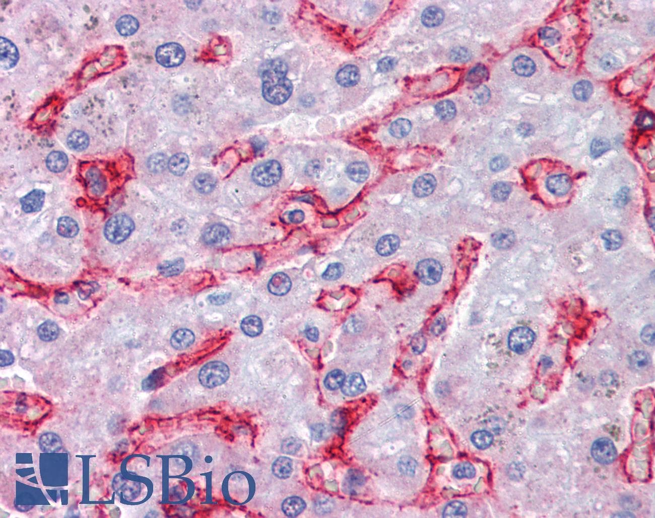 IHC-plus™ Polyclonal Goat anti-Human AOC3 / VAP-1 Antibody (aa712-724, IHC)