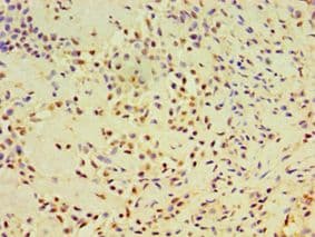 DHX58 / LGP2 Antibody (aa389-678)