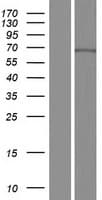CDY2A / CDY Protein (Over-Expression Lysate Myc-DDK (Flag))