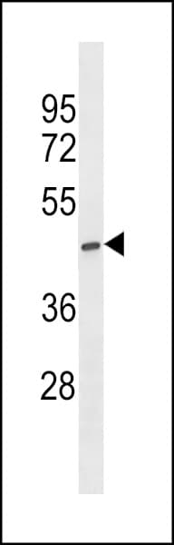 Polyclonal Rabbit anti-Human ST6GALNAC5 Antibody (aa110-138, WB)