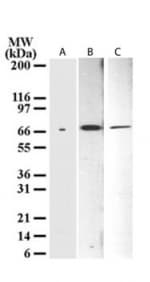 IHC-plus™ TP73 / p73 Antibody (aa2-13, clone 38C674.2)