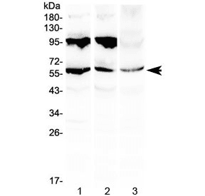 PLIN1 / Perilipin Antibody