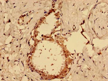 MKRN2 Antibody
