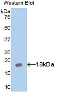 AcPL / IL18RAP Antibody (aa396-548)