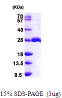 Human MOB1A Protein (Recombinant His)