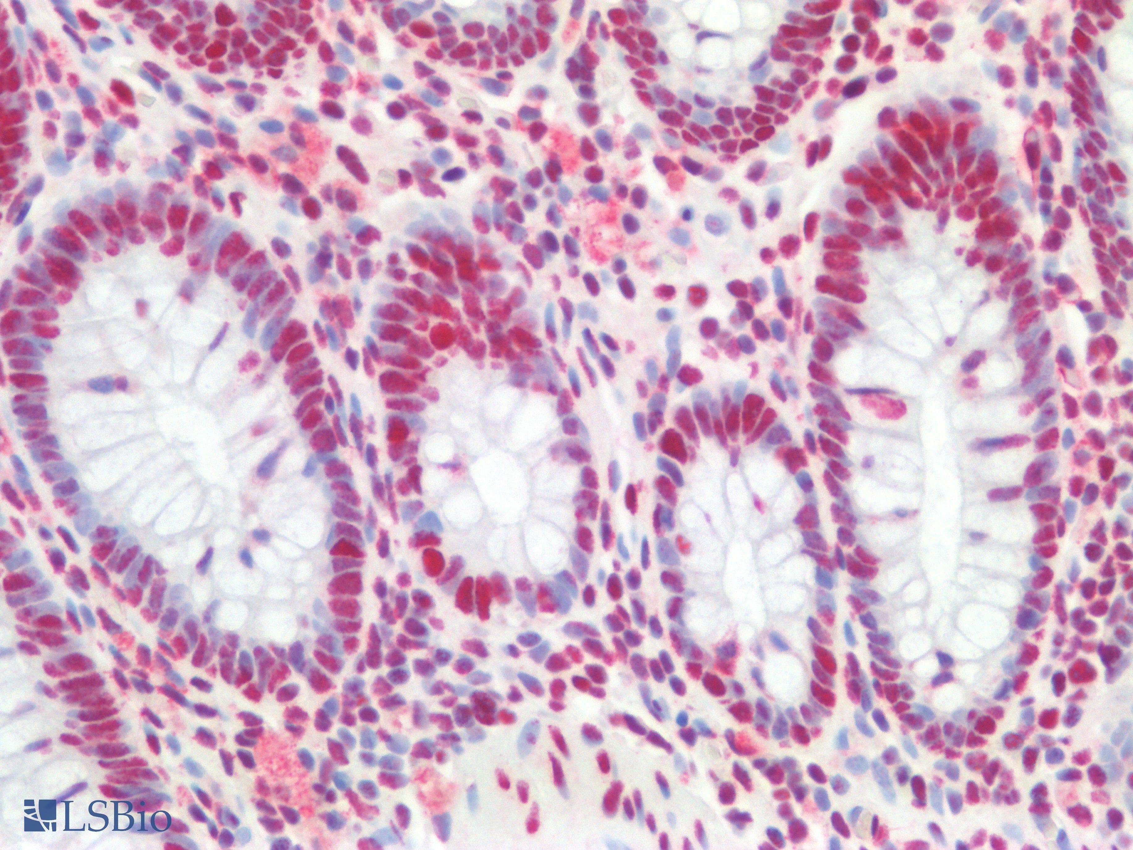 PathPlus™ NF45 / ILF2 Antibody (clone OTI6F1)