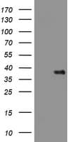 PIK3C2A Antibody (aa230-560, clone OTI3H2)