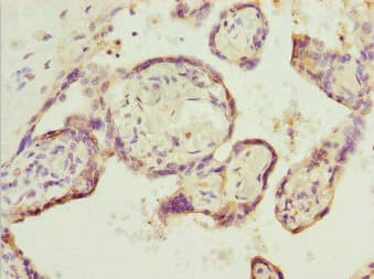 SH3GL1 / EEN Antibody