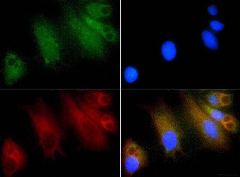 GLI / GLI1 Antibody