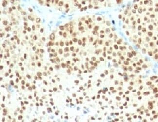 SOX10 Antibody (aa115-269, clone SPM607)