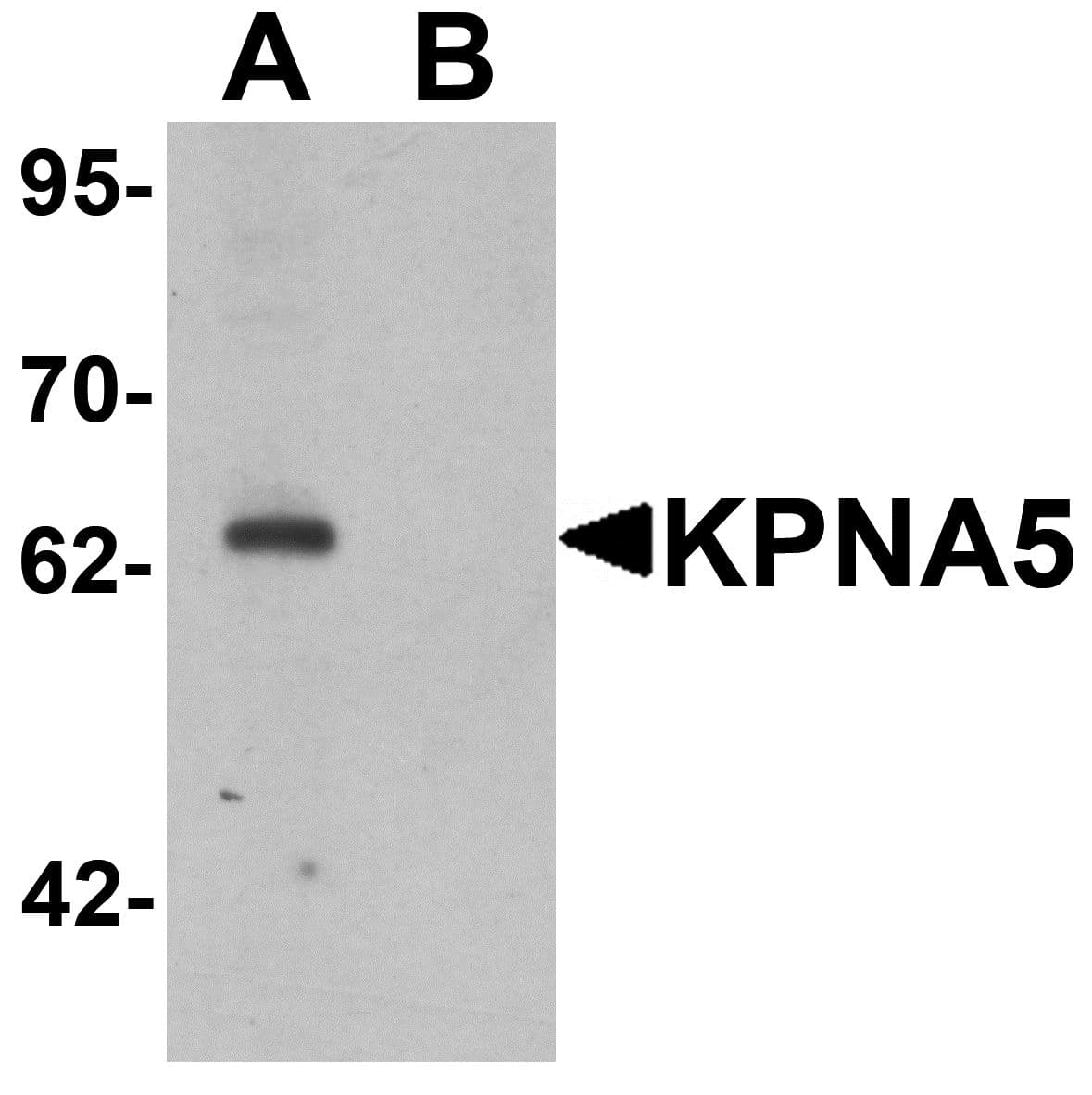 IHC-plus™ KPNA5 Antibody