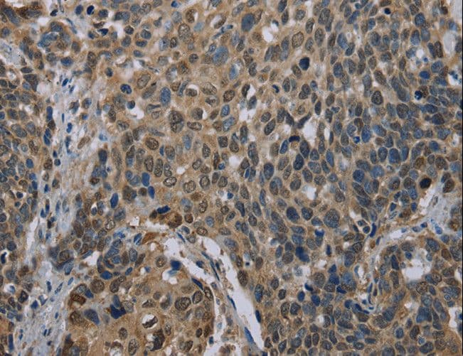 UBP1 Antibody