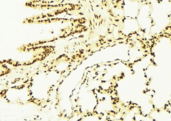 ALDH7A1 Antibody