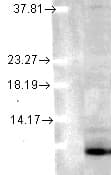 IHC-plus™ Ubiquitin Antibody (clone 6C11-B3)
