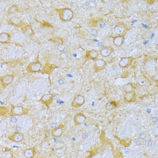 ACADSB Antibody