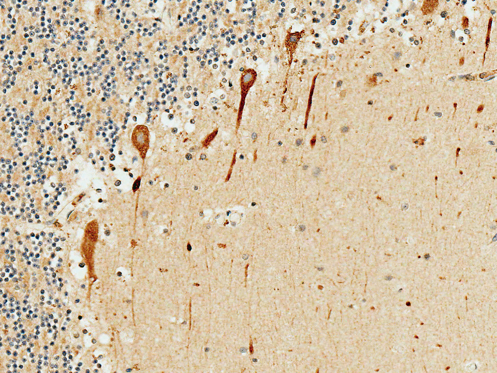 PRKCG / PKC-Gamma Antibody