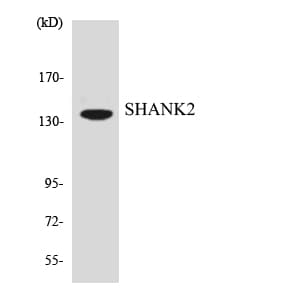 IHC-plus™ Polyclonal Rabbit anti-Human SHANK2 / SHANK Antibody (aa322-371, IHC, WB)