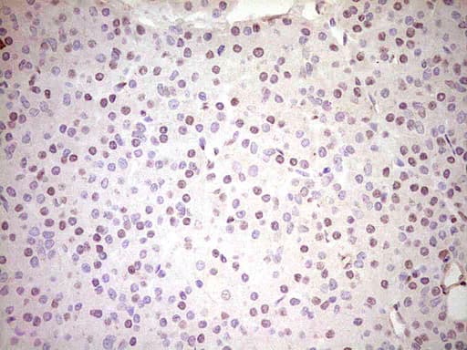 NR3C1/Glucocorticoid Receptor Antibody (aa1-265, clone OTI4C9)