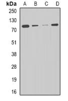 Polyclonal Rabbit anti-Human CPT2 Antibody (IHC, IF, WB)