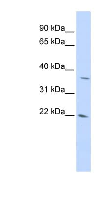 REDD-2 / DDIT4L Antibody (aa72-121)