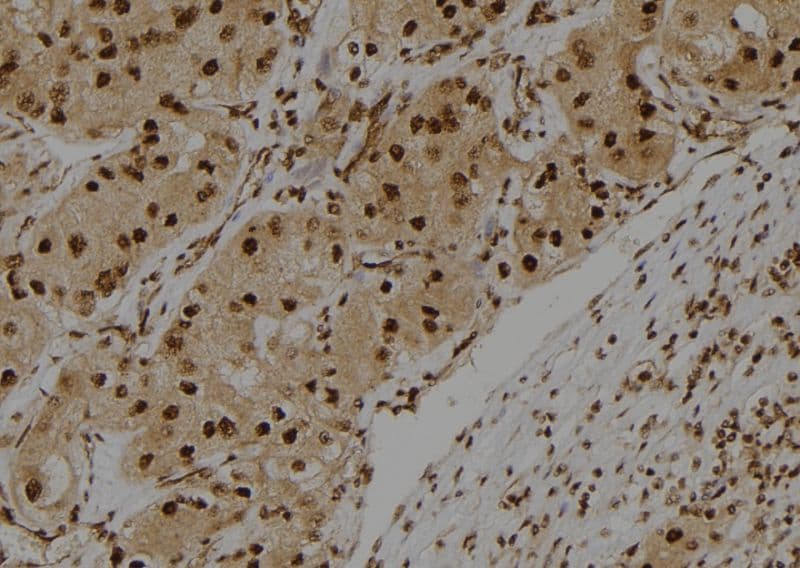 S100A3 / S100E Antibody