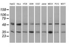 PRKAR2A Antibody (clone OTI5F1)