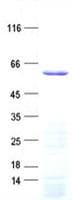 Human DYTN Protein (Recombinant His, N-Terminal)