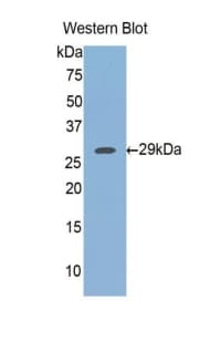 FKBP38 / FKBP8 Antibody (aa93-339)