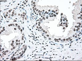 BRAF / B-Raf Antibody (clone OTI4C5)