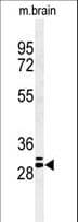 GJB2 / CX26 / Connexin 26 Antibody (aa204-226)