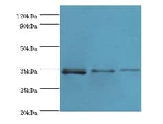 STK16 Antibody (aa1-305)