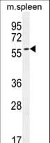 Polyclonal Rabbit anti-Human POC5 Antibody (aa368-397, WB)