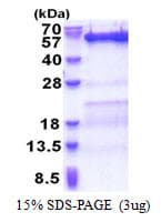Human SKD1 / VPS4B Protein (Recombinant His)