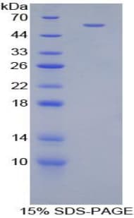 Mouse CILP Protein (Recombinant His-T7)