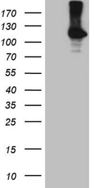 ROR2 Antibody (aa796-927, clone OTI4B10, Carrier-free)
