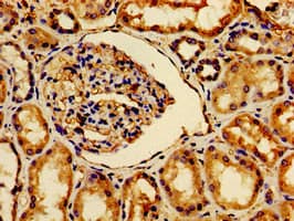 AVPR2 / V2R Antibody