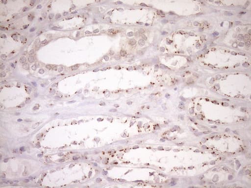 Monoclonal Mouse anti-Human TRIM56 Antibody (clone OTI5A1, aa311-554, IHC, WB)
