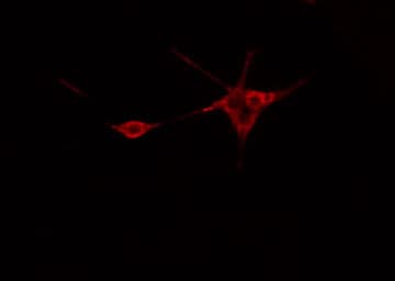 RET Antibody