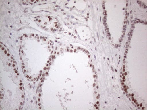 MMP2 Antibody (aa228-507, clone OTI4A11)