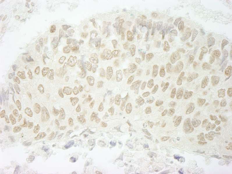 SFSWAP / SWAP Antibody (aa500-550)