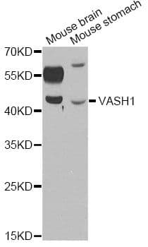 Polyclonal Rabbit anti-Human Vasohibin 1 / VASH1 Antibody (IHC, WB)