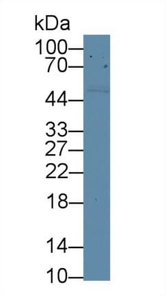 CD5 Antibody