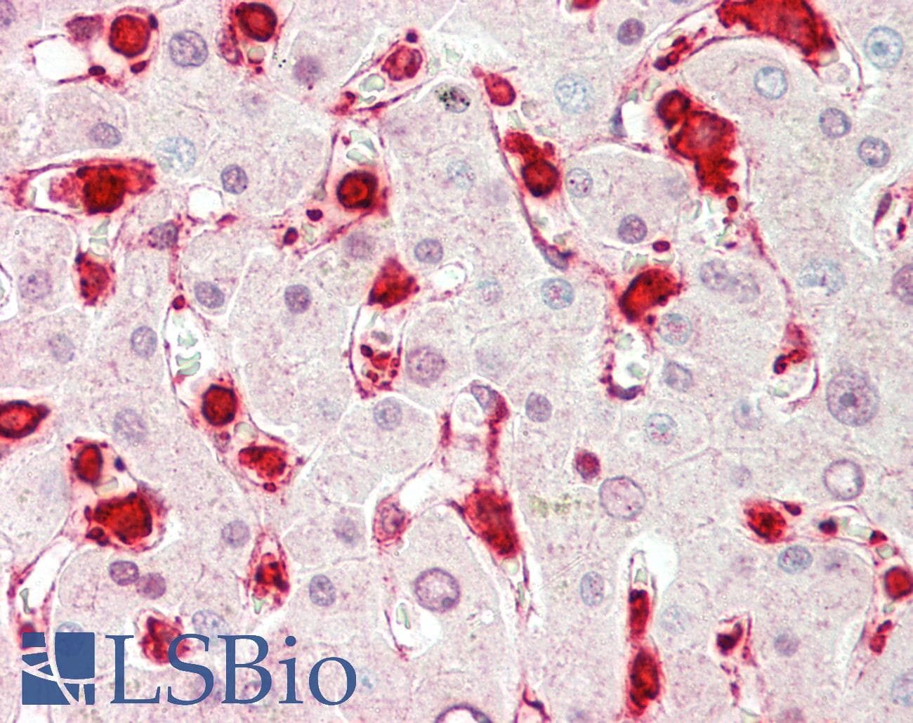 IHC-plus™ Polyclonal Rabbit anti-Human LFNG / Lunatic Fringe Antibody (aa86-114, IHC, WB)