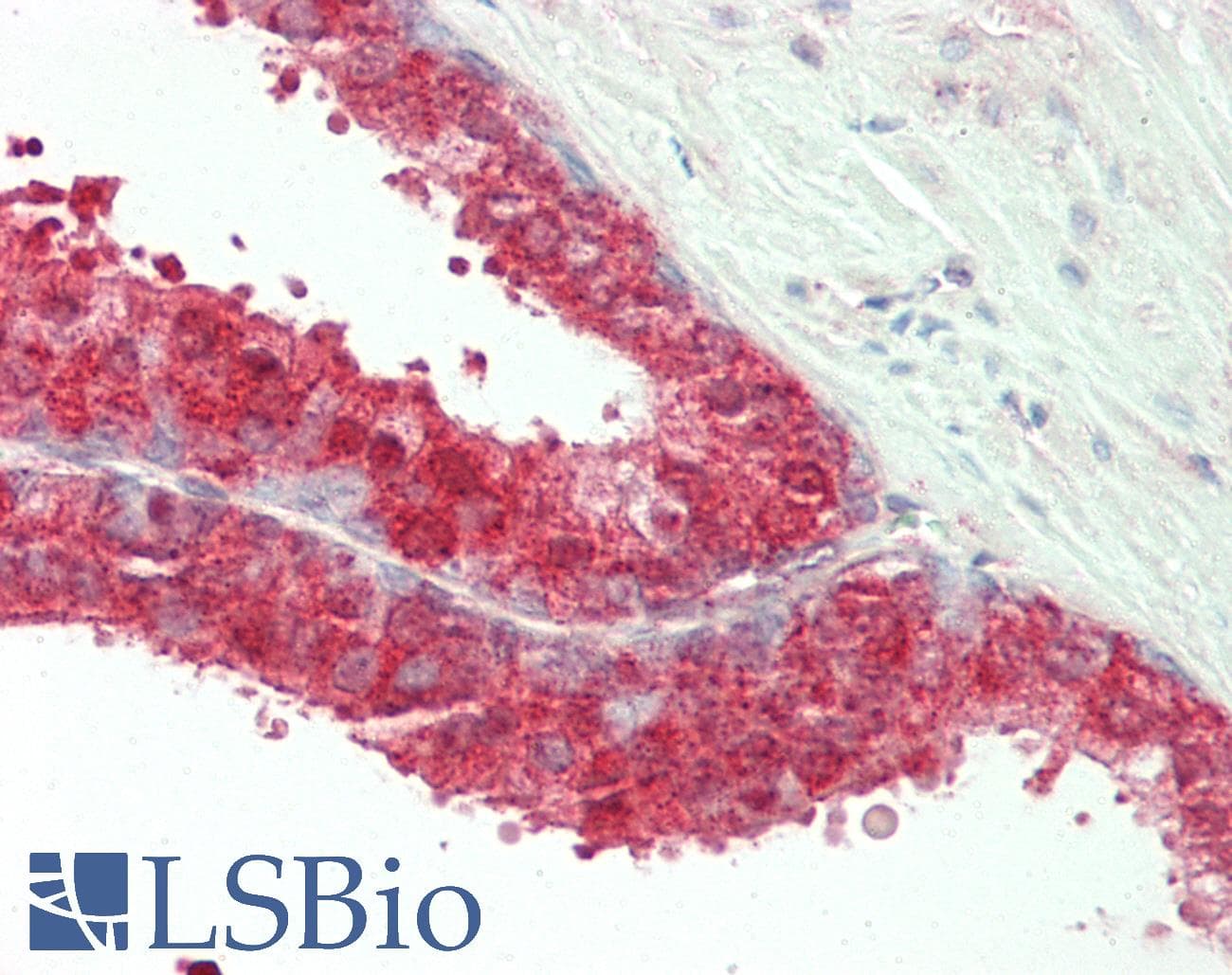 Polyclonal Rabbit anti-Human PAX8 Antibody (aa151-200, IHC, WB)