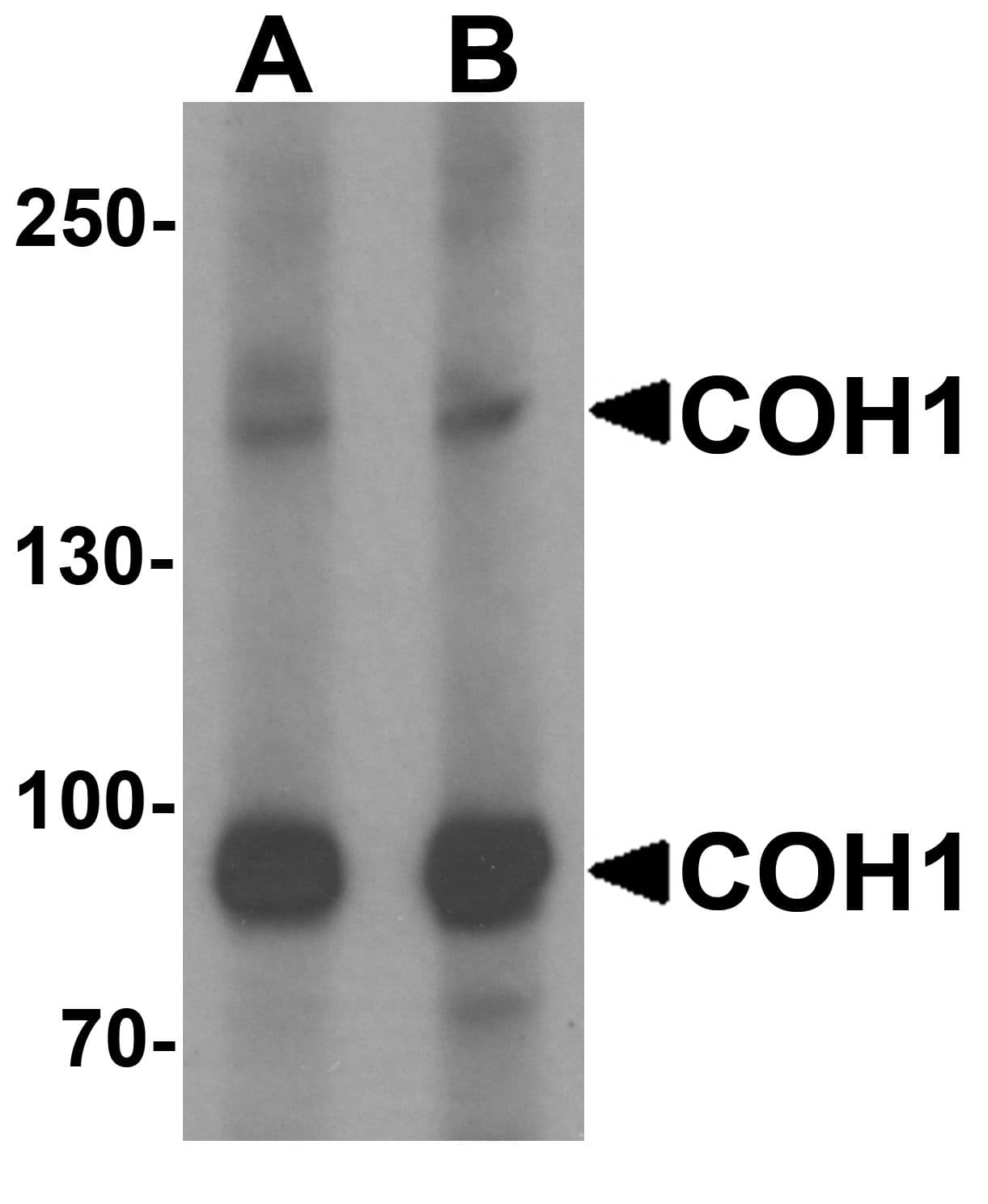 IHC-plus™ VPS13B Antibody